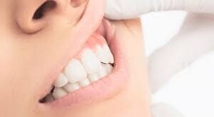 Curso De Lesões Bucais Na Infância